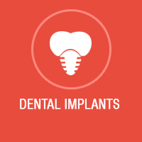 dental implants Bangalore, Dental Implant Surgery, Implant center in Bangalore, best dental implants in Bangalore, dental implants koramangala, Implant center in Koramangala, Implant Treatment Bangalore