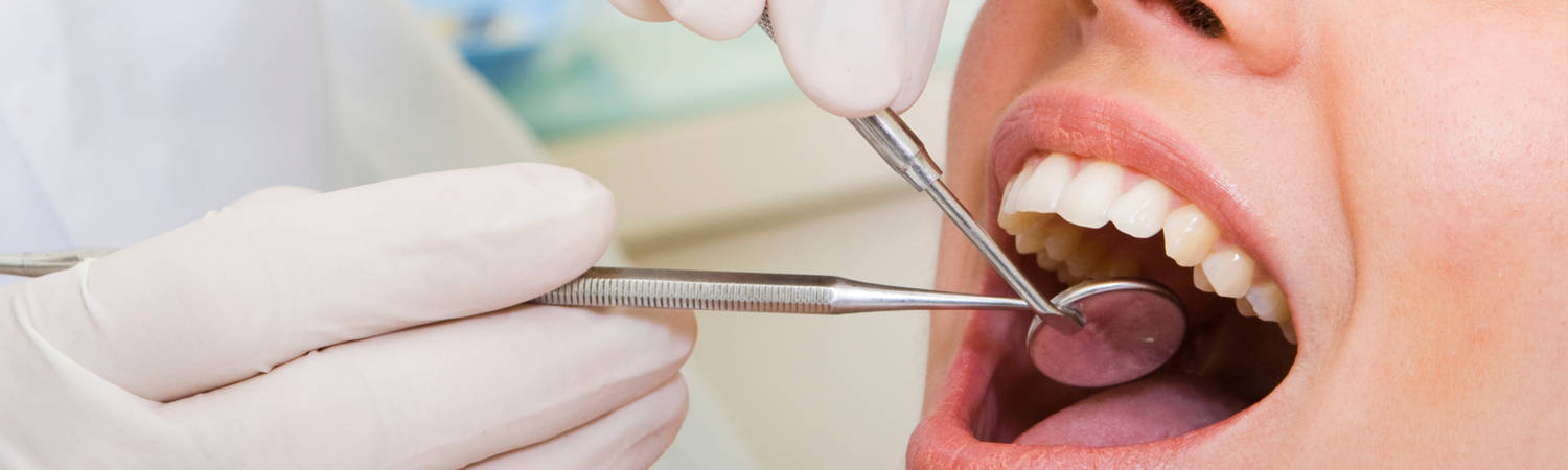good dental services in Bangalore