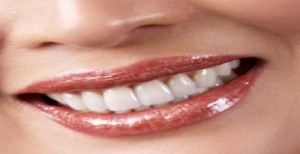 affordable Cosmetic Dentistry in Bangalore