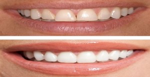 affordable Cosmetic Dentistry